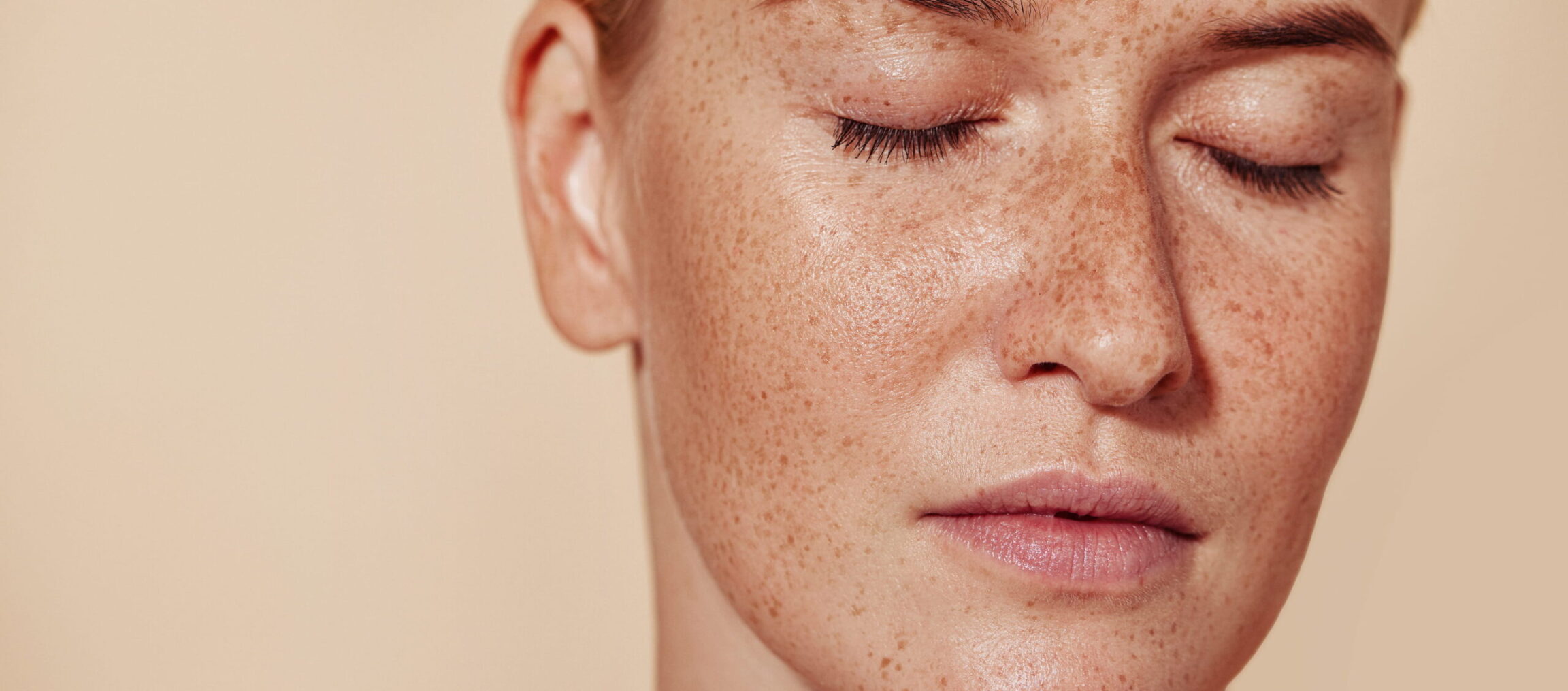 AccuTite® / FaceTite®